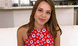 Teens Can't live without Boastfully Knobs - Teens shows off her Braces