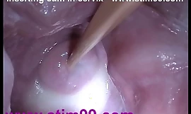 Stick wziąć spermę cum wziąć szyjkę macicy w przypadku wyrwania wzdęcia odesłać