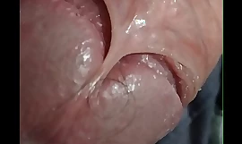virgin penis uncompromisingly zip up seen together with show skin lock of penis head